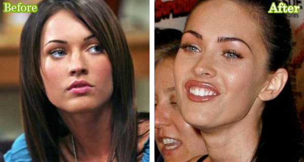 megan fox before surgery pictures. Thanks for the help Google.